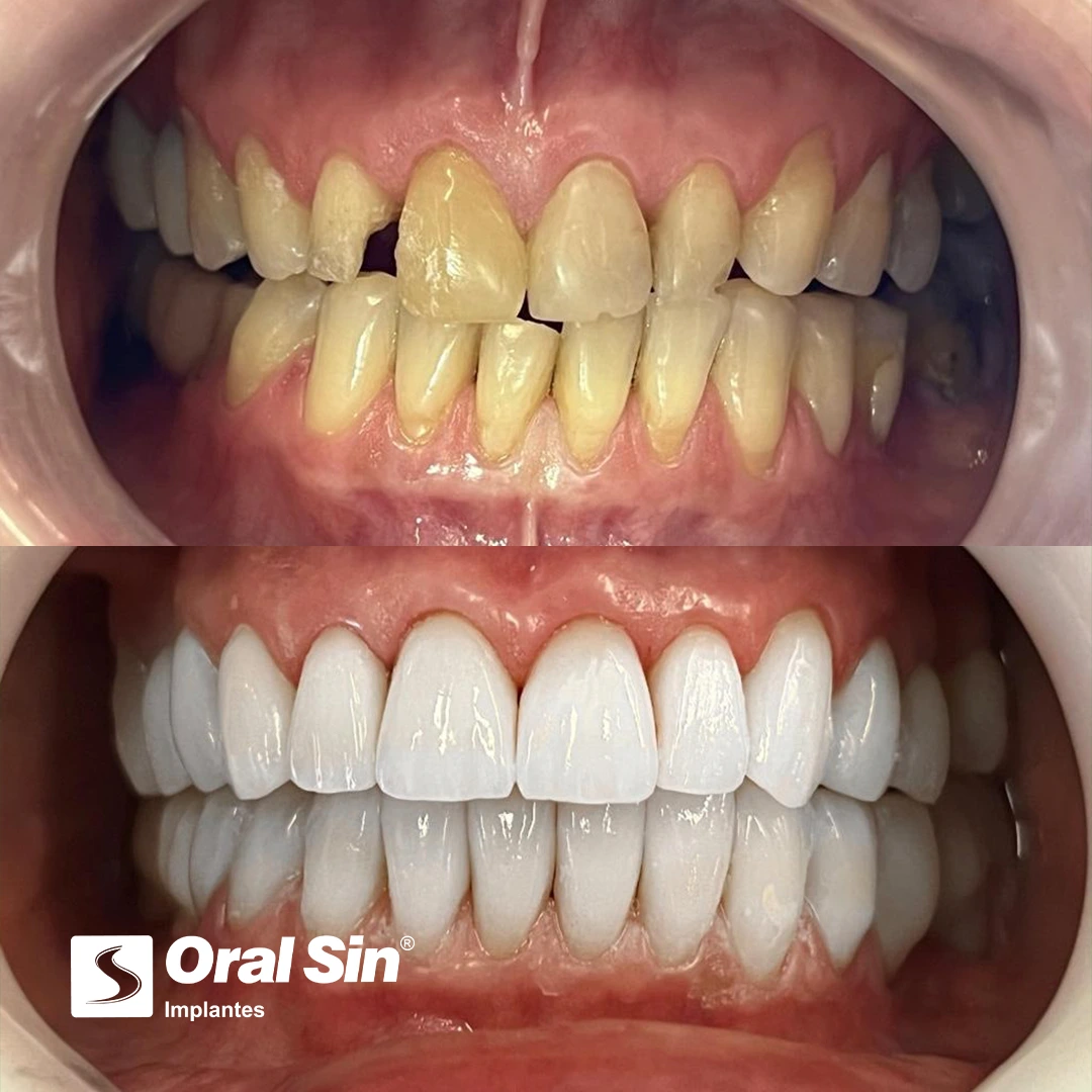 Paciente real — antes e depois 3