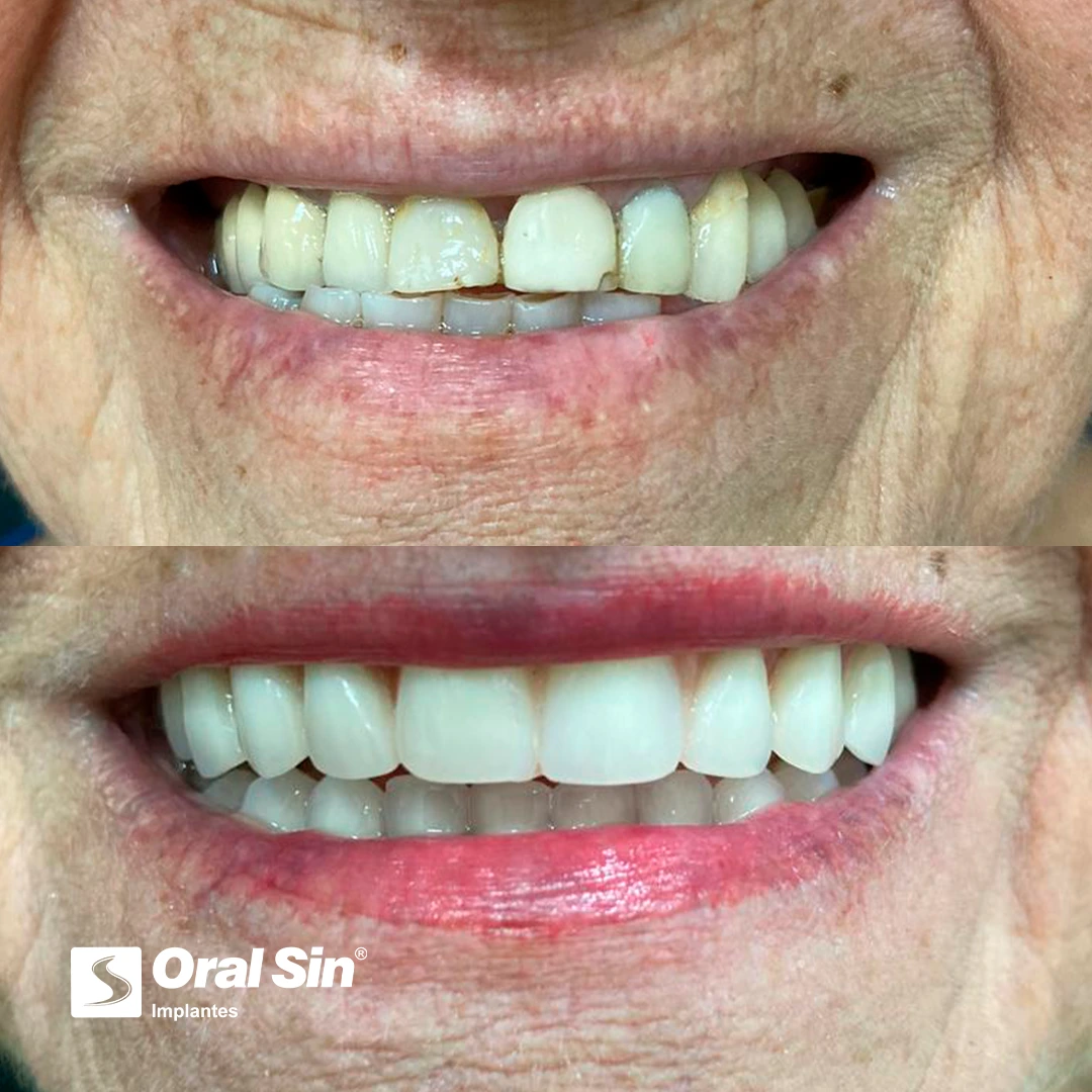 Paciente real — antes e depois 6